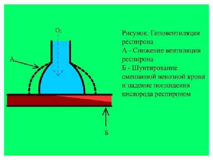 Патофизиология внешнего дыхания презентация