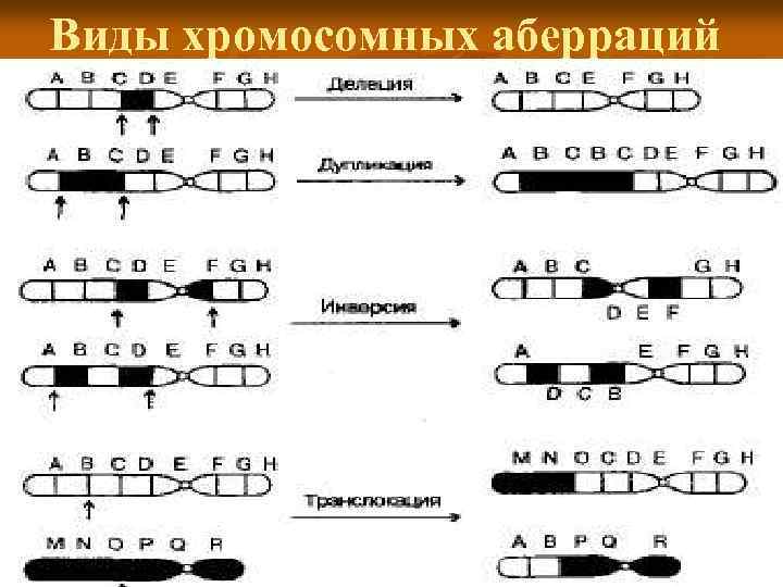 Виды хромосомных аберраций 