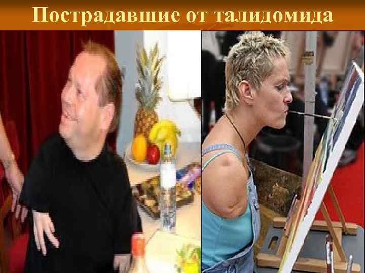 Пострадавшие от талидомида 