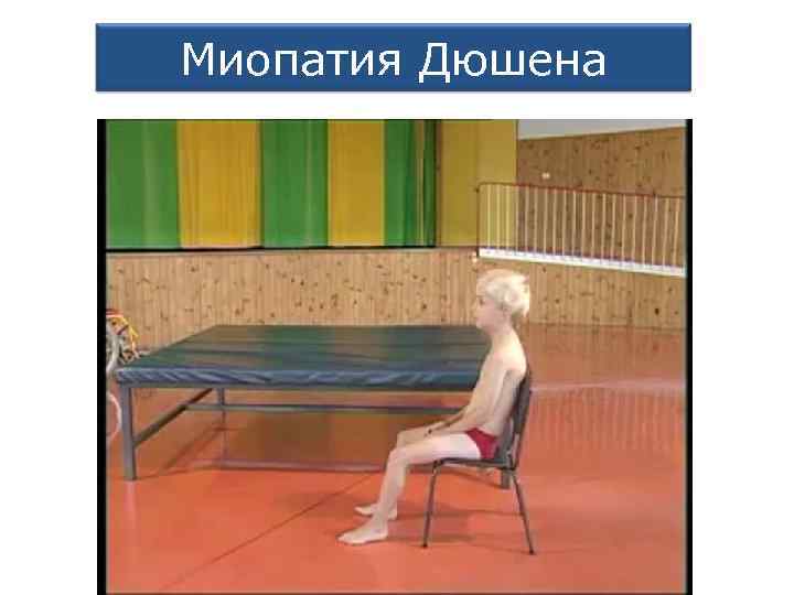 Миопатия Дюшена 