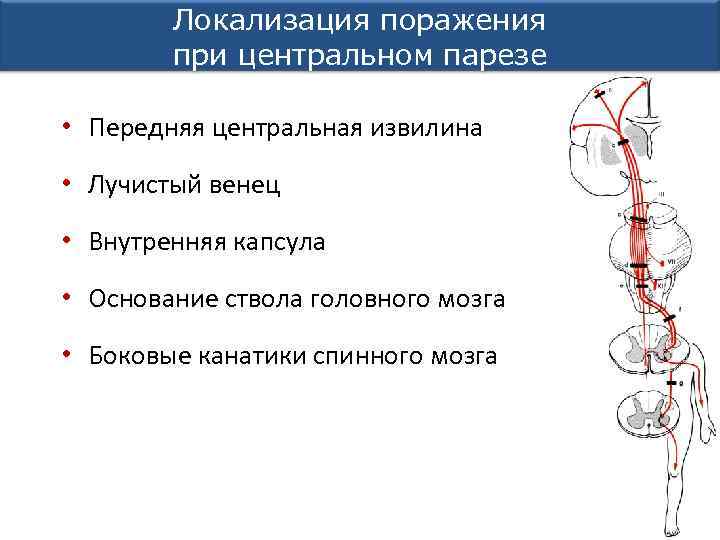 Локализация поражения при центральном парезе • Передняя центральная извилина • Лучистый венец • Внутренняя