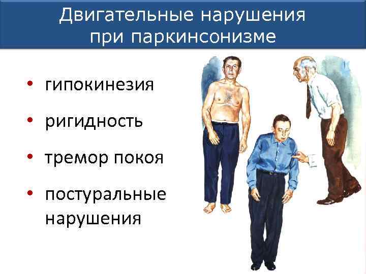Двигательные нарушения при паркинсонизме • гипокинезия • ригидность • тремор покоя • постуральные нарушения