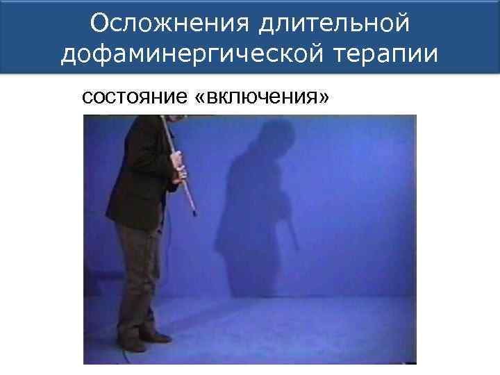 Осложнения длительной дофаминергической терапии состояние «включения» 