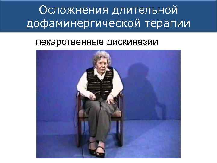 Осложнения длительной дофаминергической терапии лекарственные дискинезии 