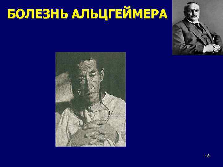 БОЛЕЗНЬ АЛЬЦГЕЙМЕРА 18 
