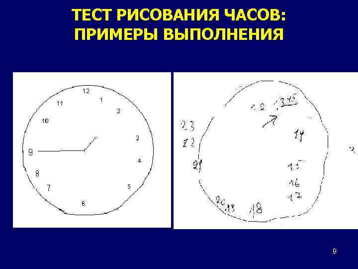 ТЕСТ РИСОВАНИЯ ЧАСОВ: ПРИМЕРЫ ВЫПОЛНЕНИЯ 9 