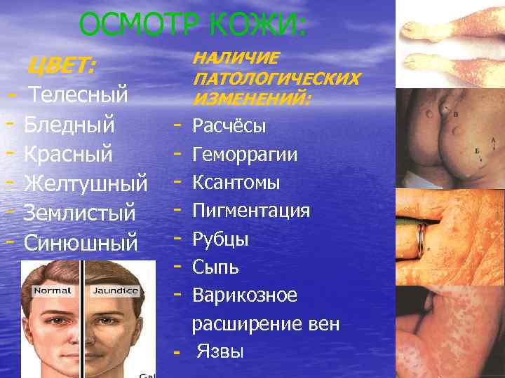 ОСМОТР КОЖИ: НАЛИЧИЕ ПАТОЛОГИЧЕСКИХ ИЗМЕНЕНИЙ: ЦВЕТ: - Телесный - Бледный Красный Желтушный Землистый Синюшный