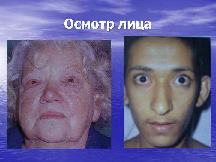 Осмотр лица 