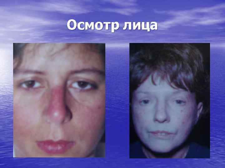 Осмотр лица 