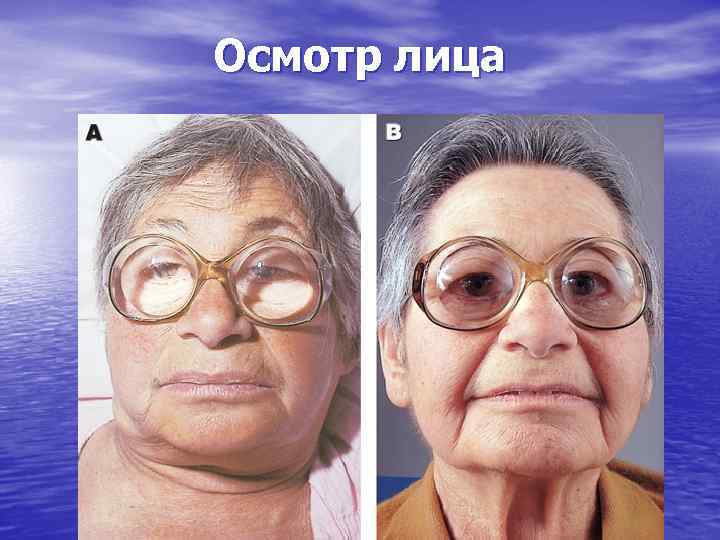 Осмотр лица 