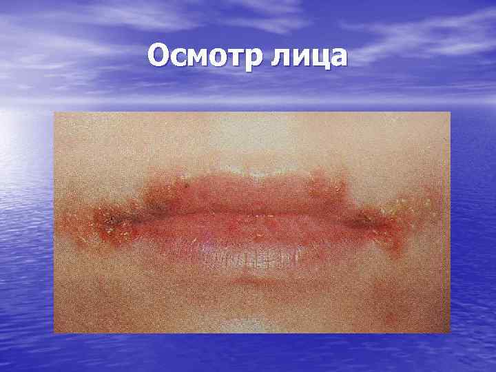 Осмотр лица 