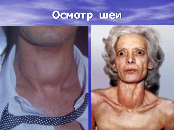 Осмотр шеи 