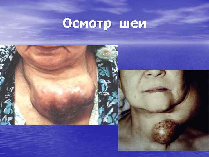 Осмотр шеи 