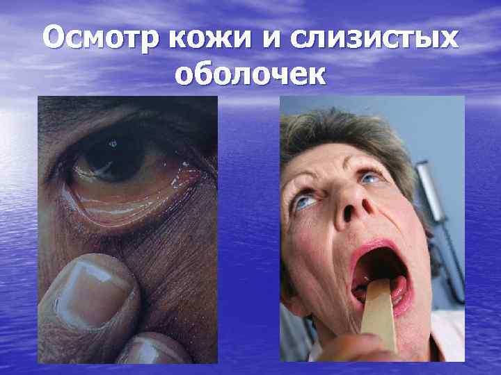 Осмотр кожи и слизистых оболочек 