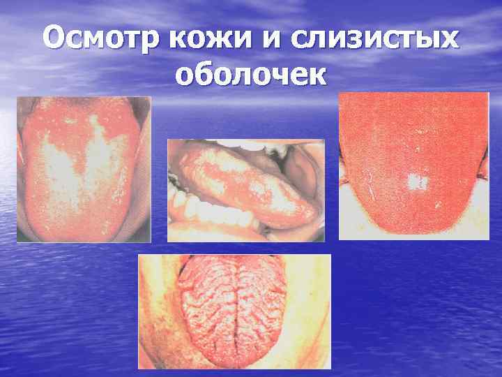 Осмотр кожи и слизистых оболочек 