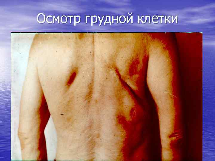 Осмотр грудной клетки 