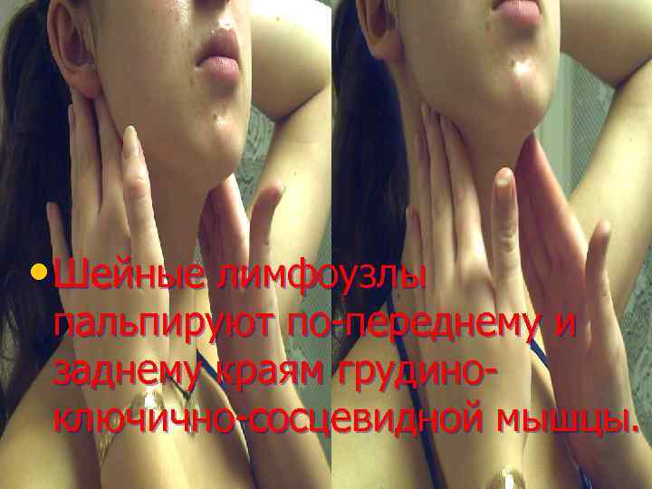  • Шейные лимфоузлы пальпируют по-переднему и заднему краям грудиноключично-сосцевидной мышцы. 