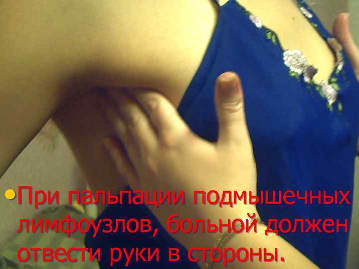  • При пальпации подмышечных лимфоузлов, больной должен отвести руки в стороны. 