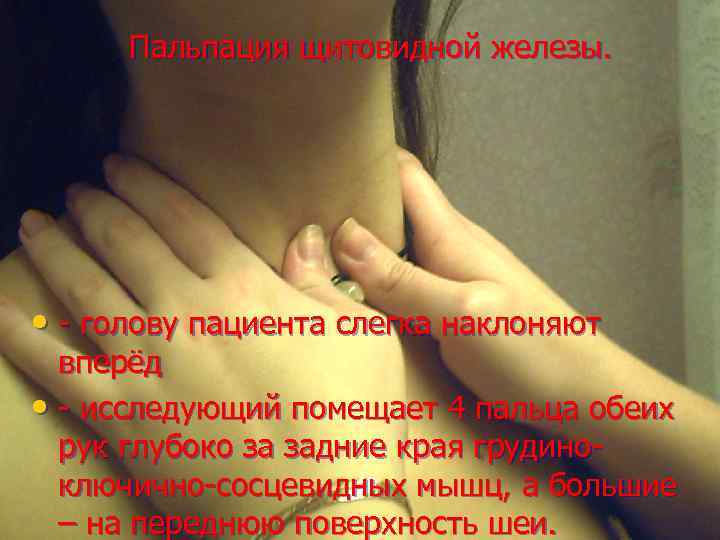 Пальпация щитовидной железы. • - голову пациента слегка наклоняют вперёд • - исследующий помещает