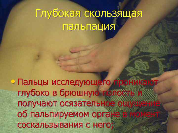 Глубокая скользящая пальпация • Пальцы исследующего проникают глубоко в брюшную полость и получают осязательное