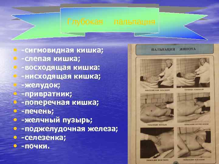 Глубокая • • • пальпация -сигмовидная кишка; -слепая кишка; -восходящая кишка: -нисходящая кишка; -желудок;