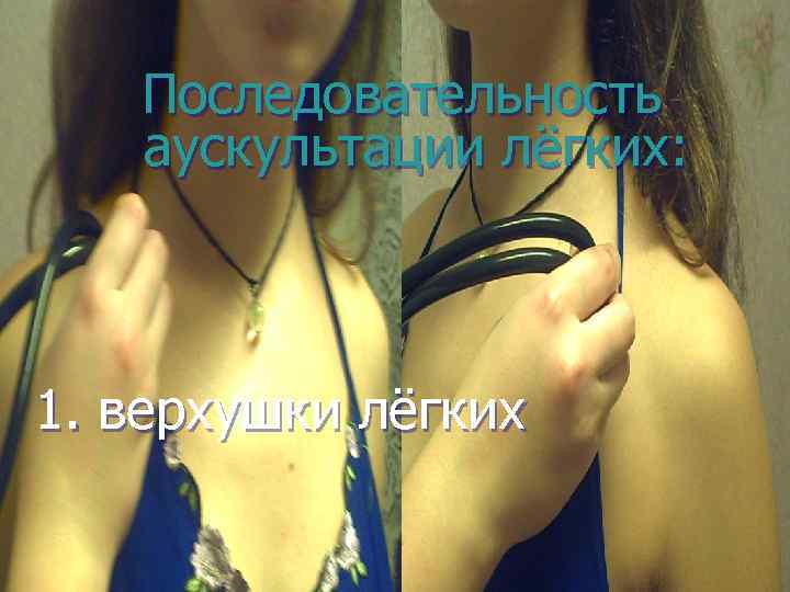 Последовательность аускультации лёгких: 1. верхушки лёгких 