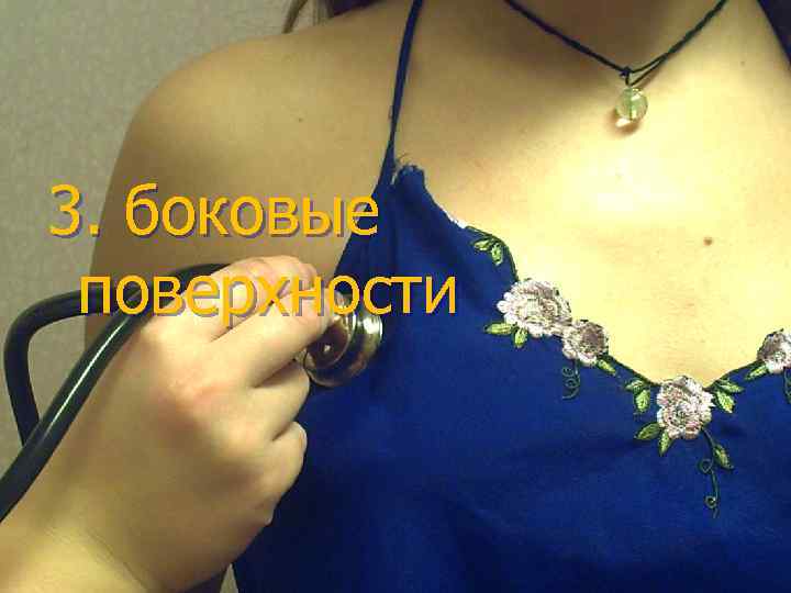 3. боковые поверхности 