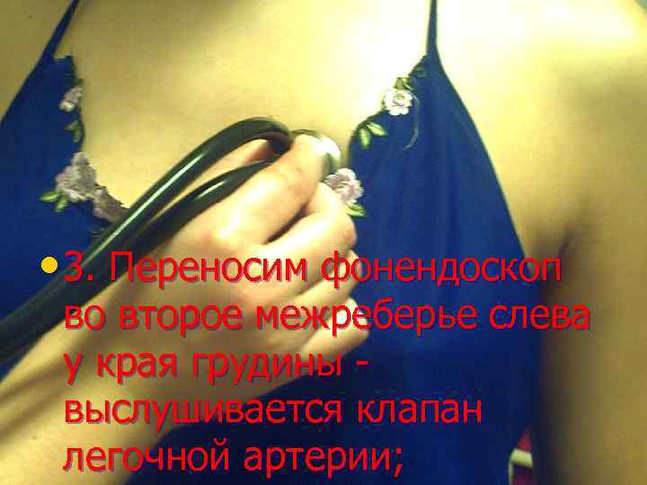  • 3. Переносим фонендоскоп во второе межреберье слева у края грудины выслушивается клапан