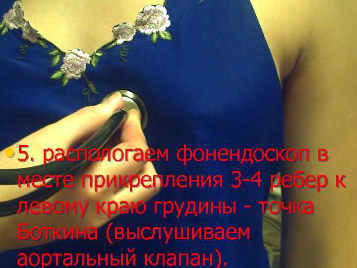  • 5. распологаем фонендоскоп в месте прикрепления 3 -4 ребер к левому краю