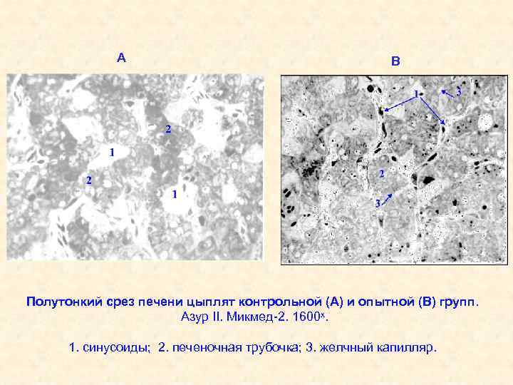 А В Полутонкий срез печени цыплят контрольной (А) и опытной (В) групп. Азур II.