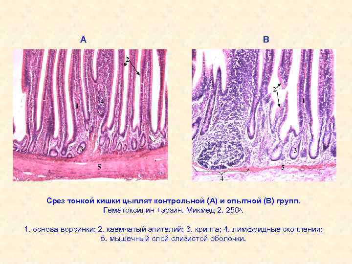 Ткани кишечника. Тонкая кишка гематоксилин эозин. Эпителий тонкой кишки гематоксилин эозин. Срез тонкой кишки эпителий. Толстая кишка гистология складки.