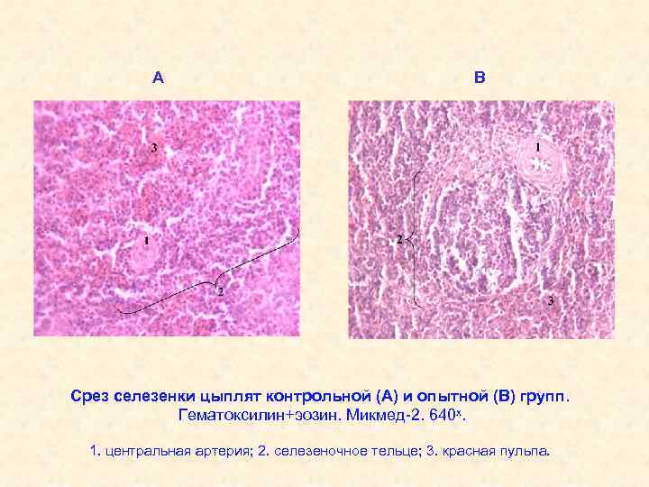 А В Срез селезенки цыплят контрольной (А) и опытной (В) групп. Гематоксилин+эозин. Микмед-2. 640