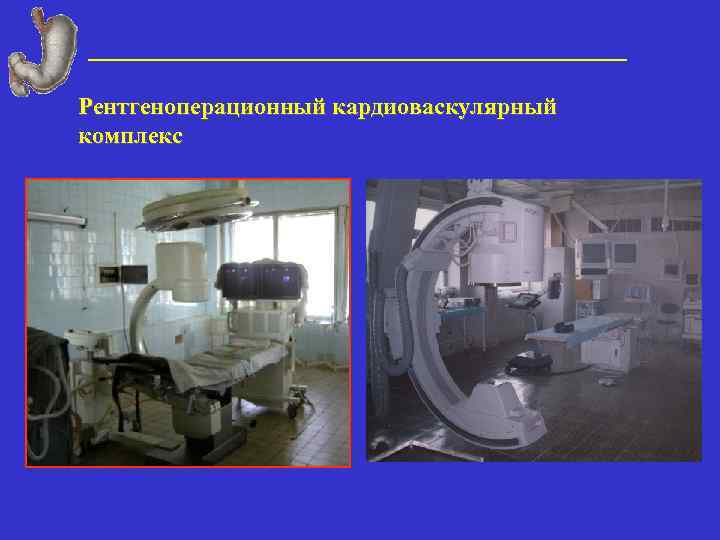Рентгеноперационный кардиоваскулярный комплекс 