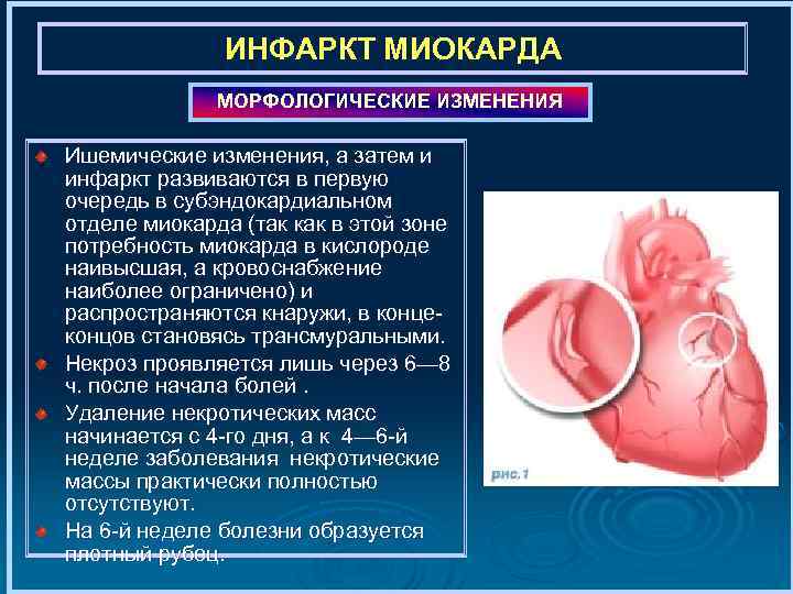 ИНФАРКТ МИОКАРДА МОРФОЛОГИЧЕСКИЕ ИЗМЕНЕНИЯ Ишемические изменения, а затем и инфаркт развиваются в первую очередь