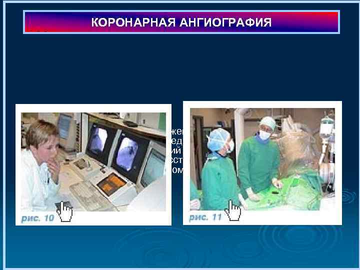КОРОНАРНАЯ АНГИОГРАФИЯ Полученное изображение позволяет врачу достоверно определить (рис. 10 -11) наличие изменений в
