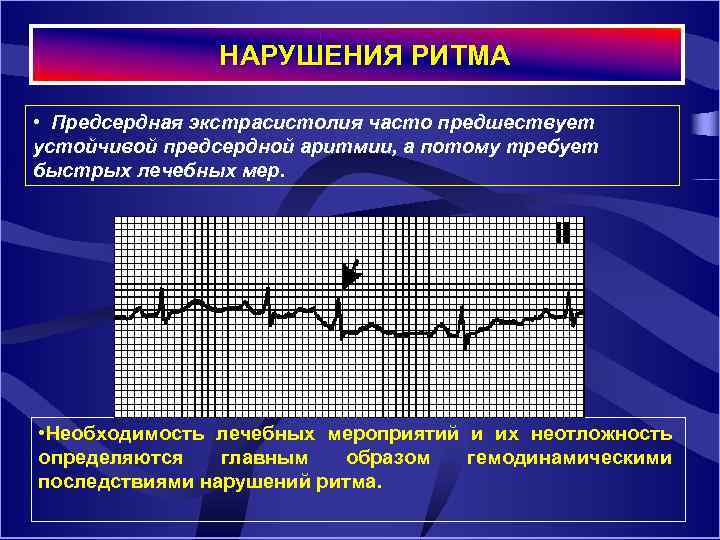 Экстрасистолия сердца что это