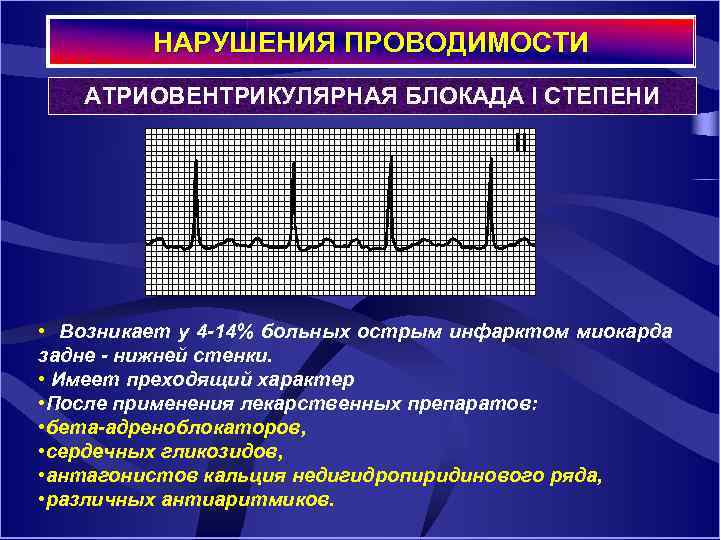 Что значит нарушение проводимости