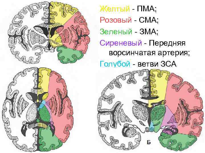 Желтый - ПМА; Розовый - СМА; Зеленый - ЗМА; Сиреневый - Передняя ворсинчатая артерия;