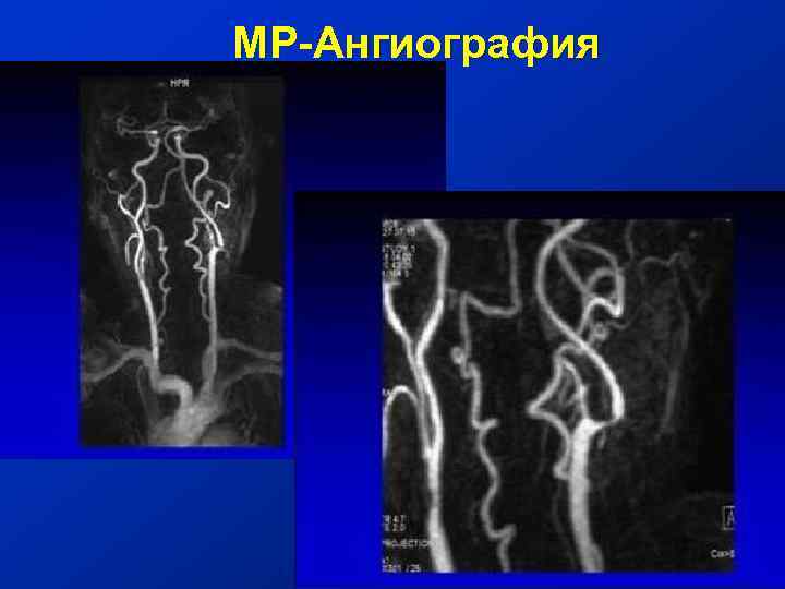 МР-Ангиография 