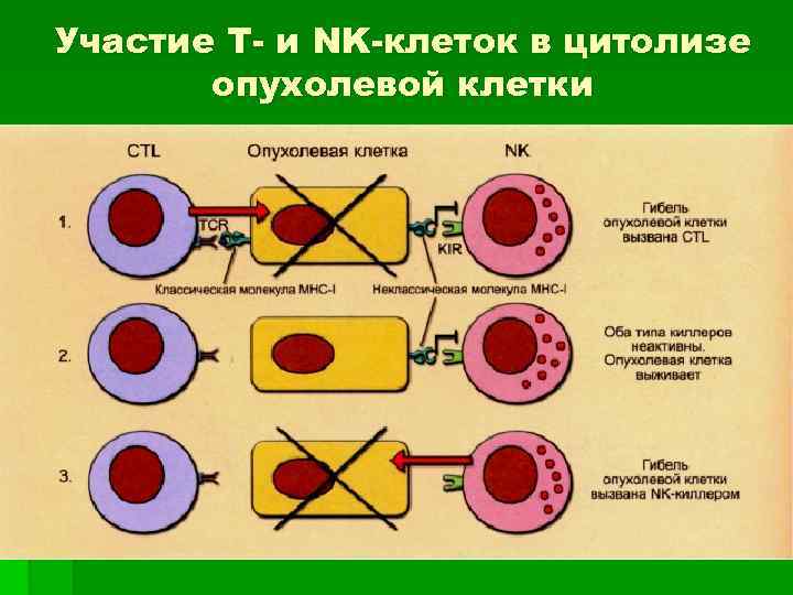 Участие Т- и NK-клеток в цитолизе опухолевой клетки 