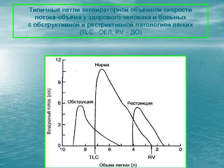 Типичные петли экспираторной объемной скорости потока-объема у здорового человека и больных с обструктивной и