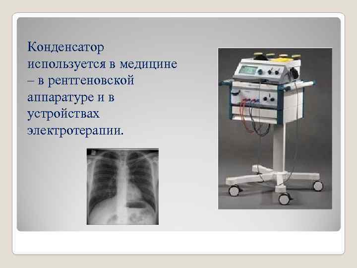 Конденсатор используется в медицине – в рентгеновской аппаратуре и в устройствах электротерапии. 