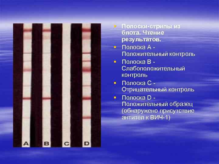 § Полоски-стрипы из блота. Чтение результатов. § Полоска А - Положительный контроль § Полоска