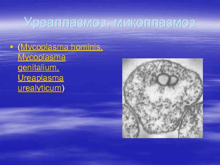 Уреаплазмоз, микоплазмоз § (Mycoplasma hominis, Mycoplasma genitalium, Ureaplasma urealyticum) 