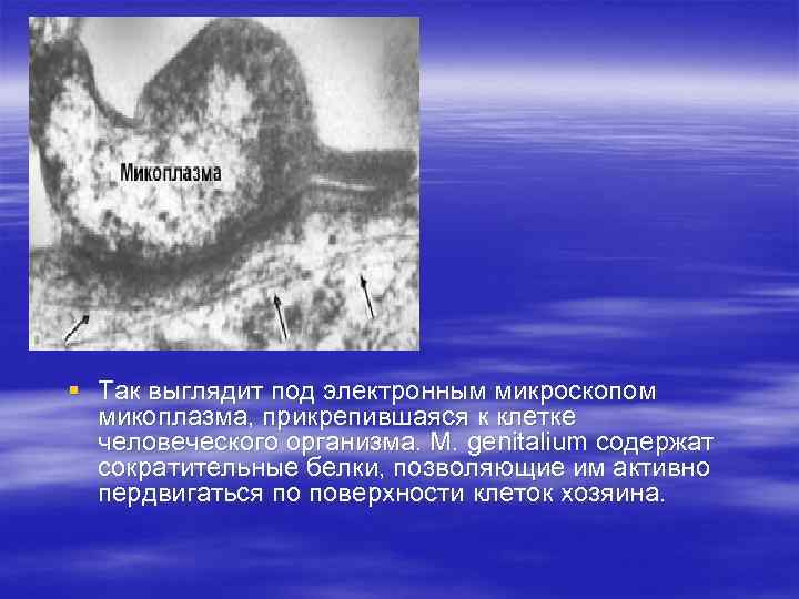 § Так выглядит под электронным микроскопом микоплазма, прикрепившаяся к клетке человеческого организма. M. genitalium