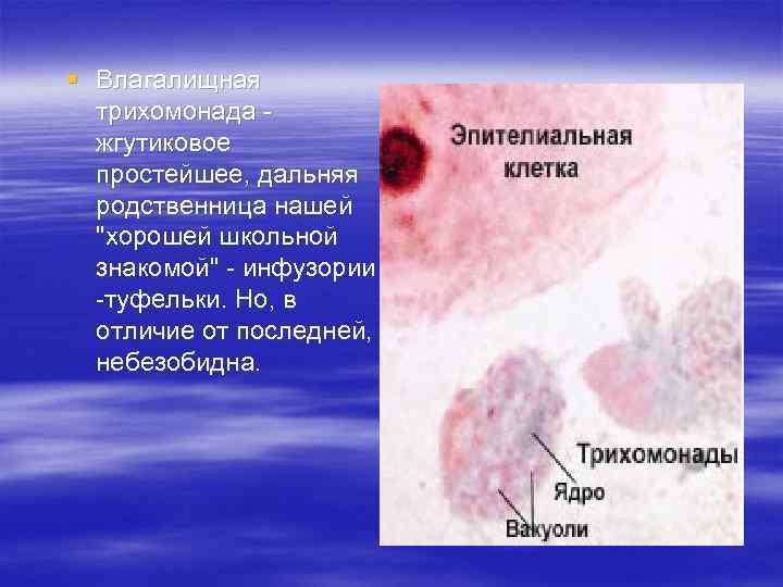 § Влагалищная трихомонада - жгутиковое простейшее, дальняя родственница нашей 