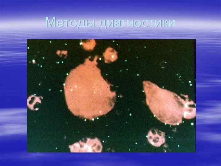 Методы диагностики 