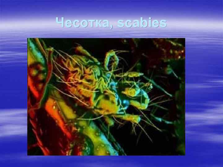 Чесотка, scabies 