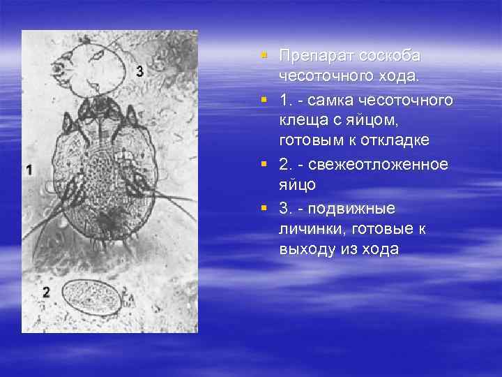 § Препарат соскоба чесоточного хода. § 1. - самка чесоточного клеща с яйцом, готовым