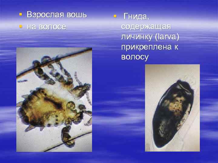 § Взрослая вошь § на волосе § Гнида, содержащая личинку (larva) прикреплена к волосу